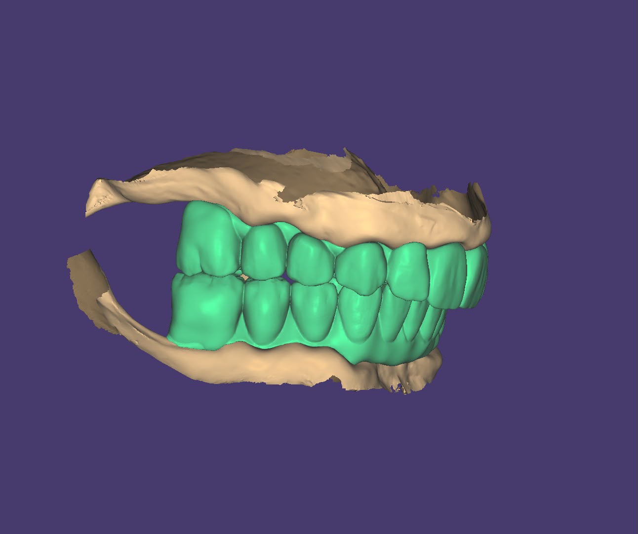 Modelo 3D lateral